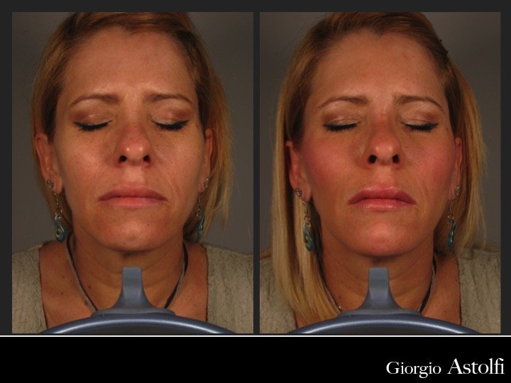 Diapositiva199