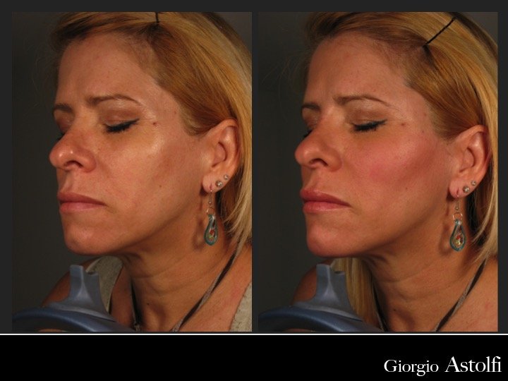 Diapositiva200