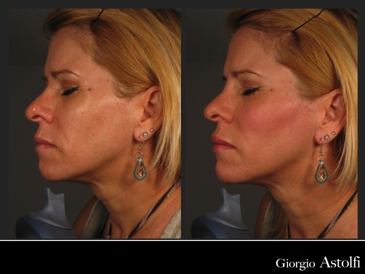 Diapositiva201