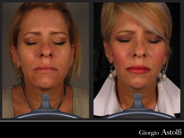 Diapositiva202