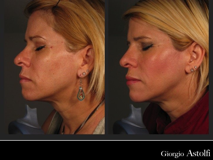 Diapositiva203