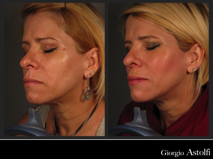 Diapositiva204