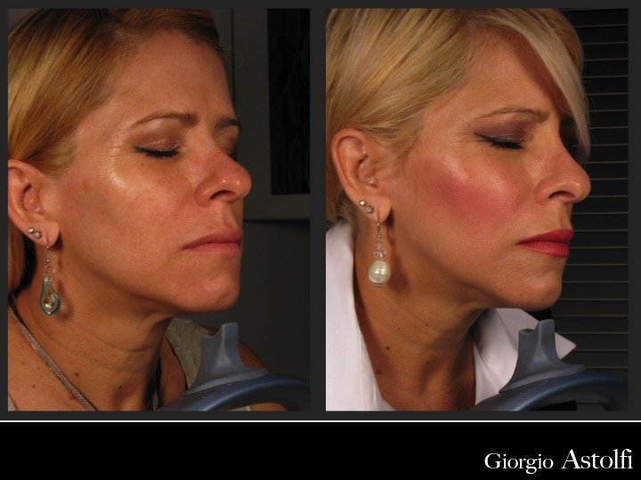 Diapositiva205