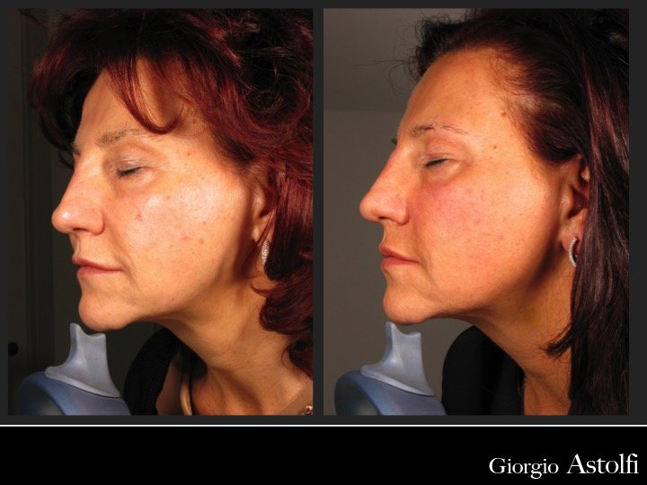 Diapositiva208