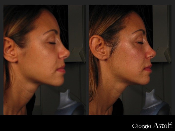 Diapositiva210