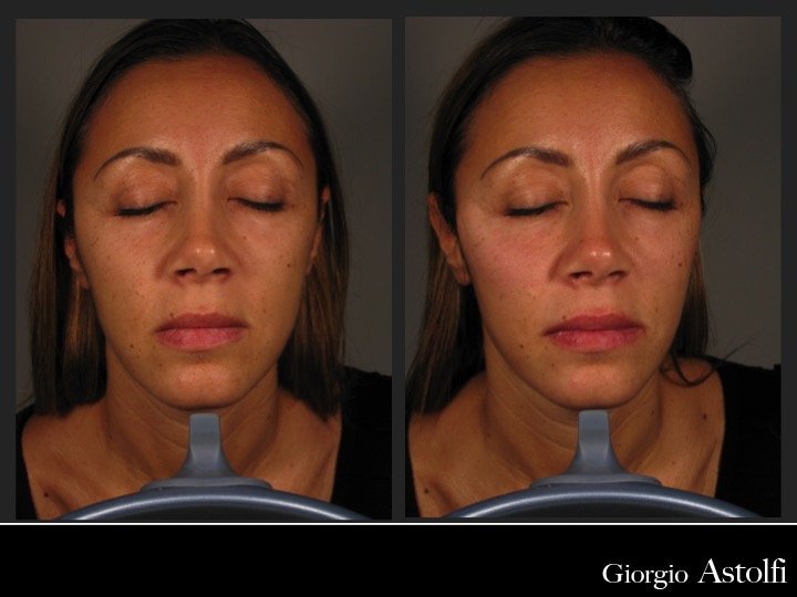Diapositiva211