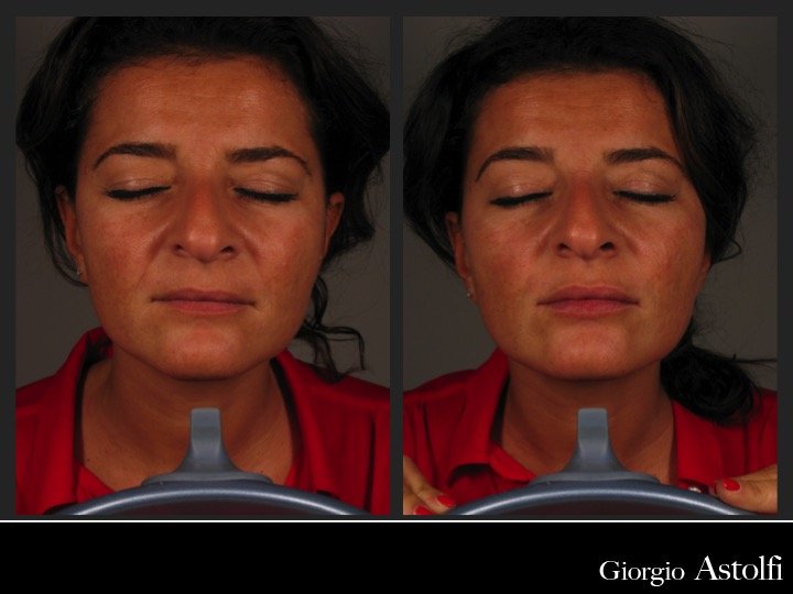 Diapositiva212