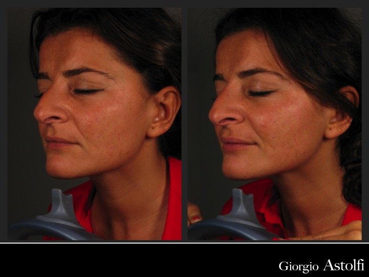 Diapositiva214