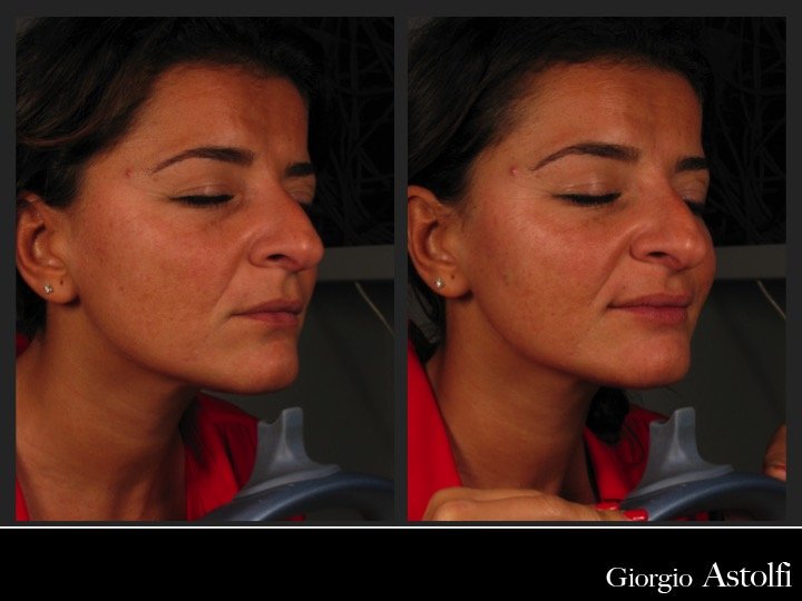 Diapositiva215