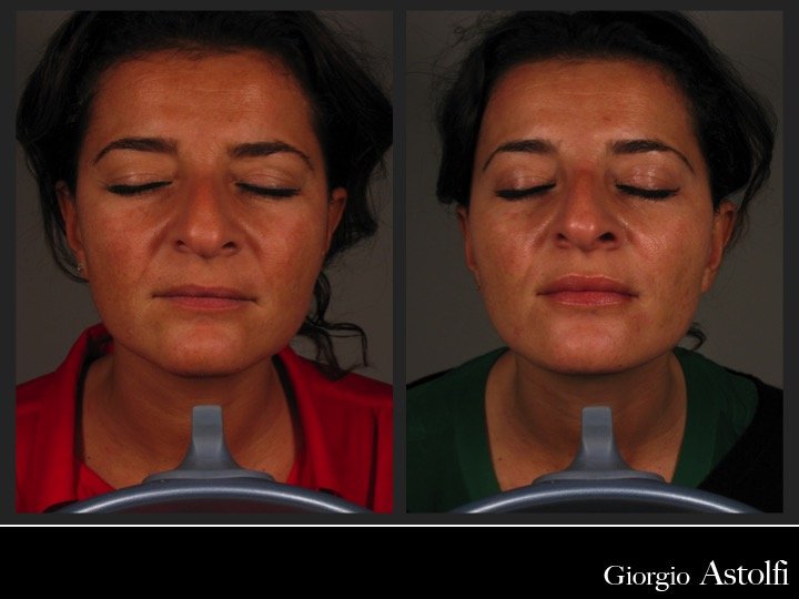 Diapositiva216