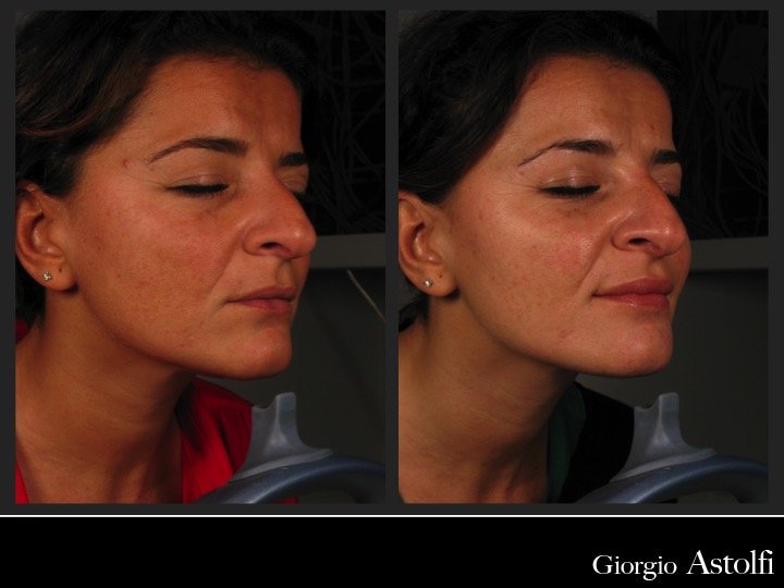 Diapositiva219