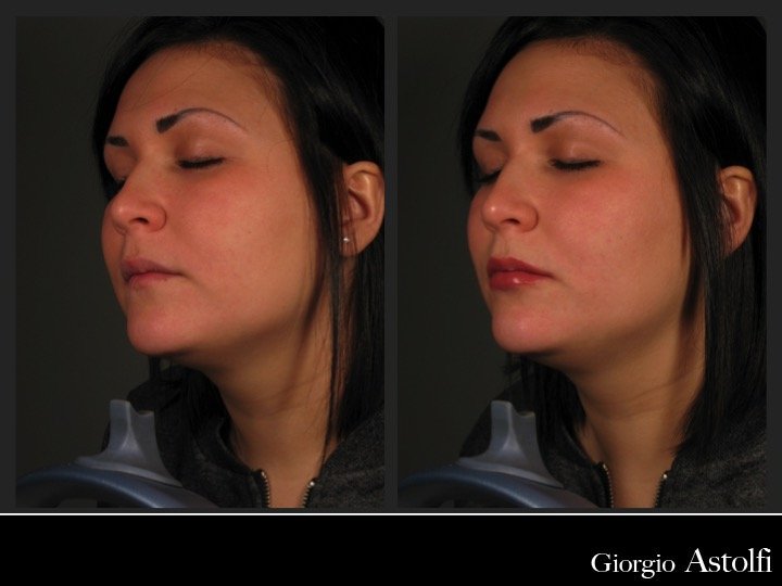 Diapositiva221