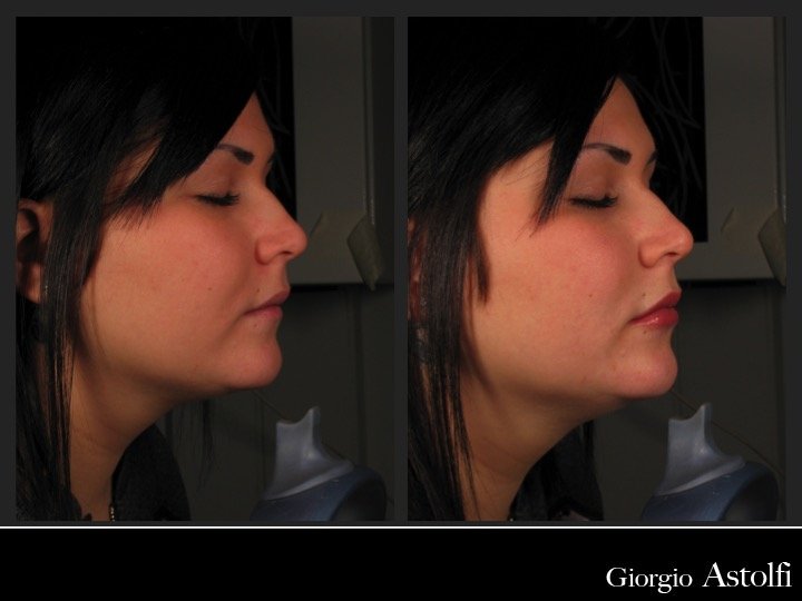 Diapositiva222