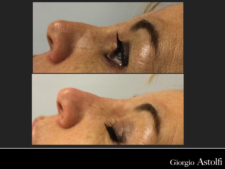 Diapositiva223