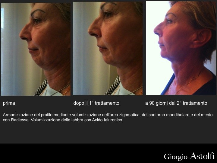 Diapositiva30